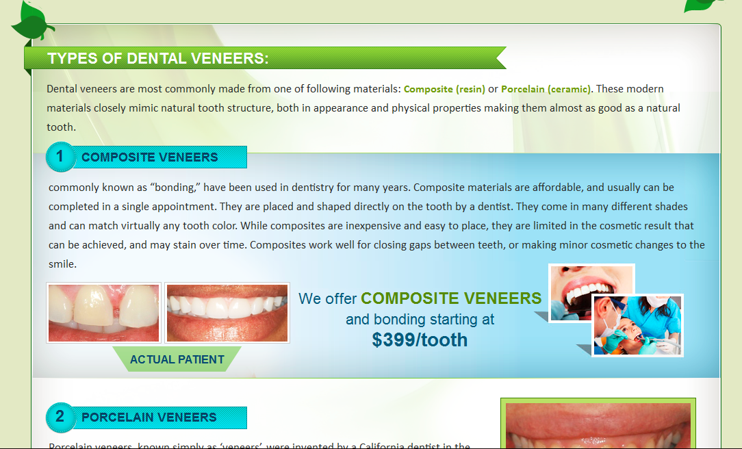 Veneer Types